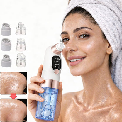 Secret Supreme™ – Aspirateur de Pores