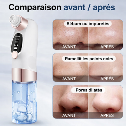 Secret Supreme™ – Aspirateur de Pores